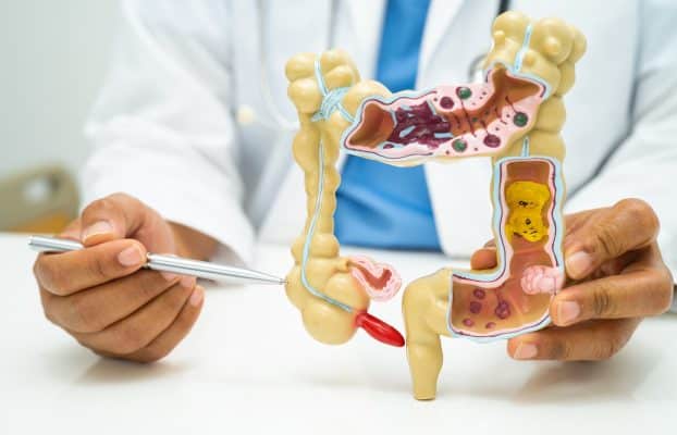 Clínica San Juan de Dios Lima | Nº 1 en Traumatología y Rehabilitación 17 CÁNCER DE COLON: UNA ENFERMEDAD SILENCIOSA PERO PREVENIBLE